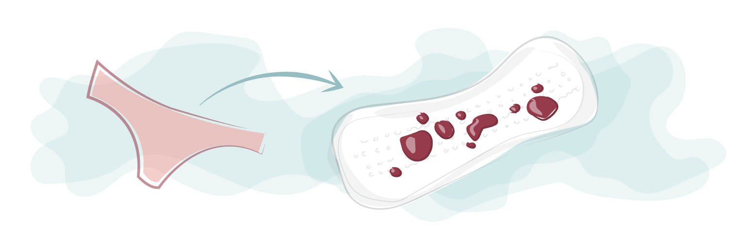 Last van klonten en stolsels bij de menstruatie?