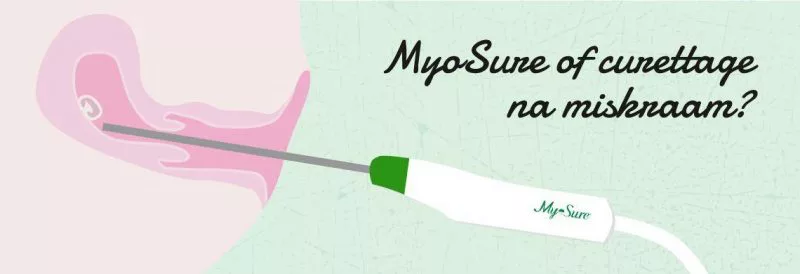 MyoSure behandeling na een miskraam